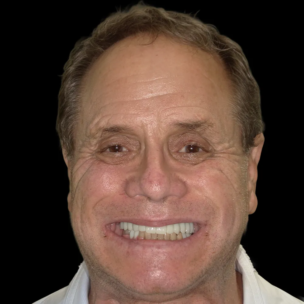 After Advanced Implantology